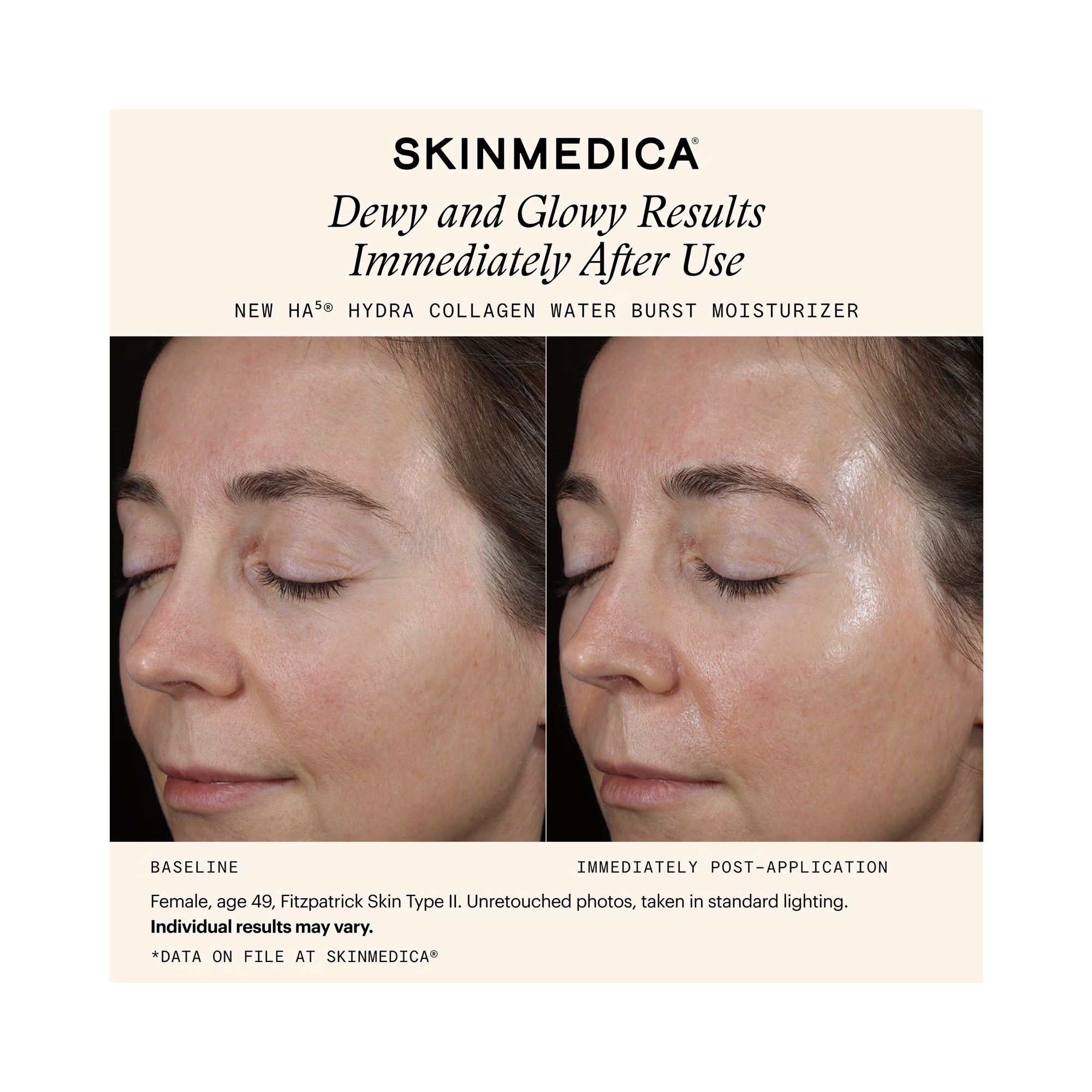 SkinMedica HA5 Hydra Collagen Water Burst Moisturizer / 1.7OZ