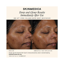 SkinMedica HA5 Hydra Collagen Water Burst Moisturizer / 1.7OZ