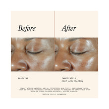 SkinMedica HA5 Hydra Collagen Hydrator / 1.7OZ