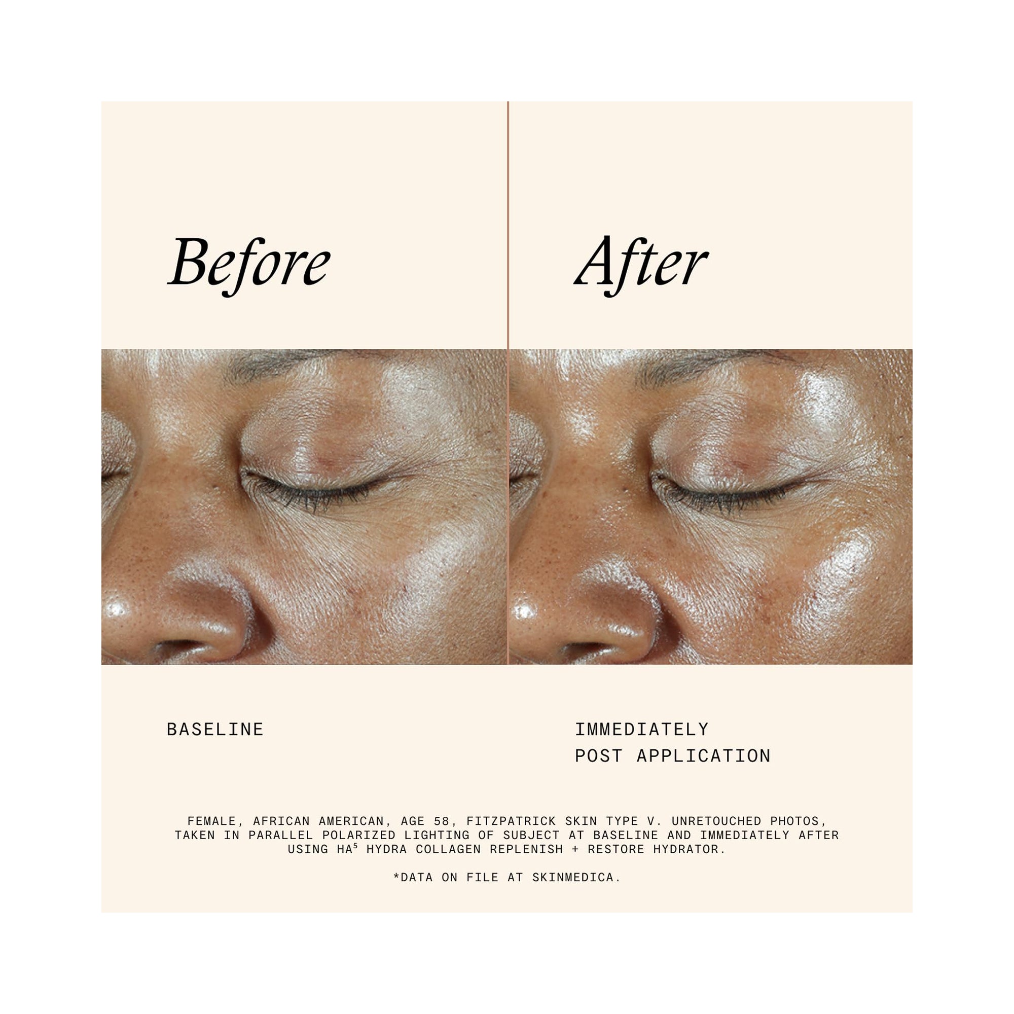 SkinMedica HA5 Hydra Collagen Hydrator / 1.7OZ