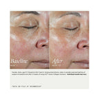 SkinMedica HA5 Hydra Collagen Facial Mist / 3.4OZ