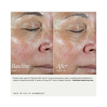 SkinMedica HA5 Hydra Collagen Facial Mist / 3.4OZ