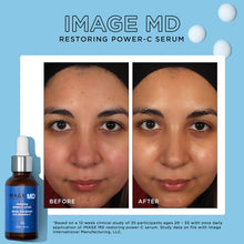 Image Skincare Image MD Restoring Power-C Serum / 1OZ