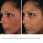 Image Skincare Ormedic Balancing Anti-Oxidant Serum / 1OZ