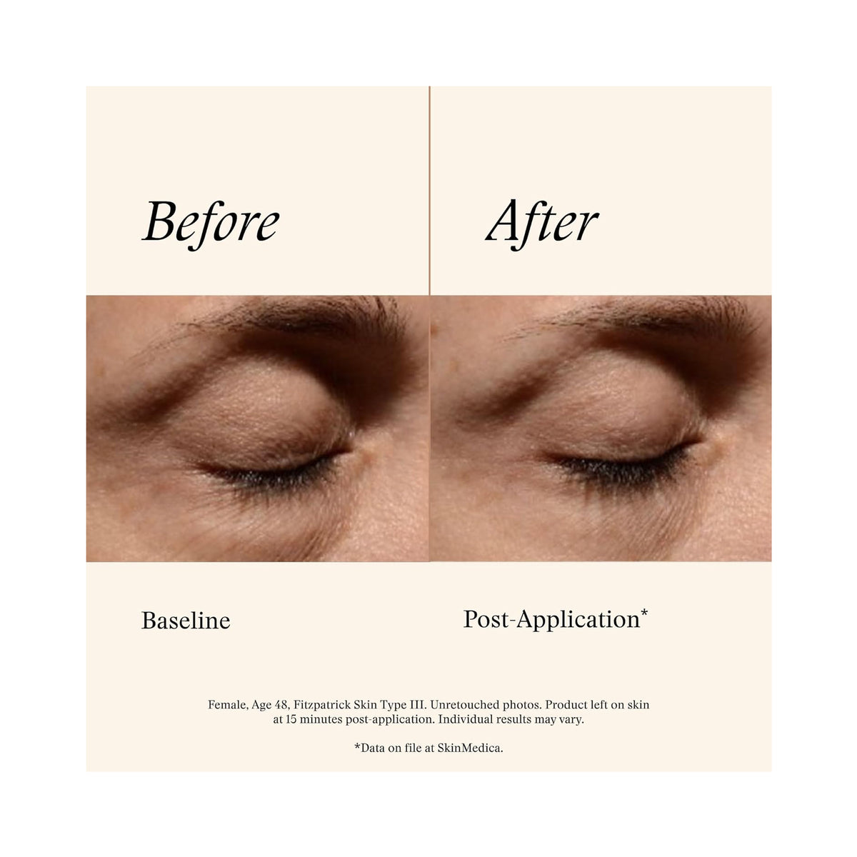 SkinMedica Instant Bright Eye Cream / 0.5OZ, image 31844928946326
