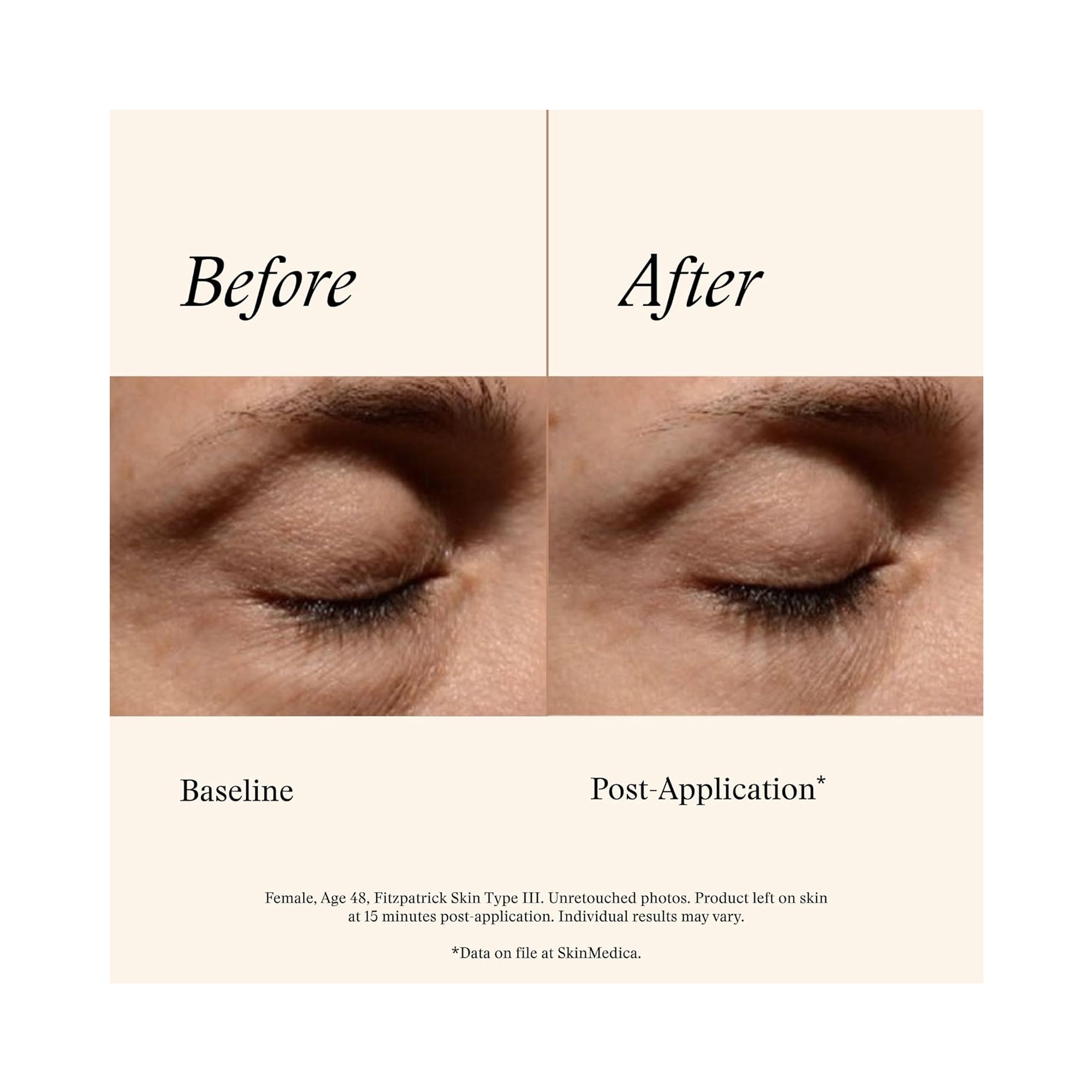 SkinMedica Instant Bright Eye Cream / 0.5OZ