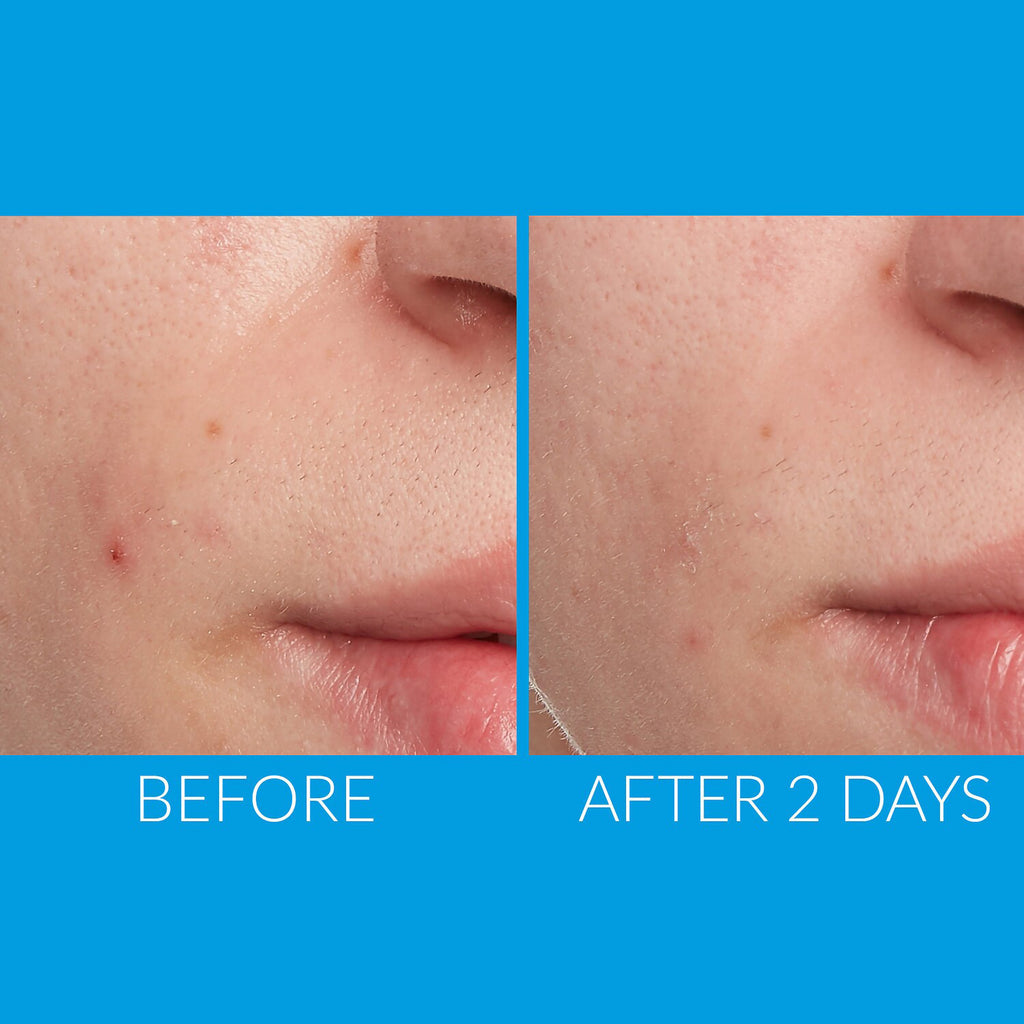 Kate Somerville EradiKate Acne Treatment / 1 OZ thumbnail 3