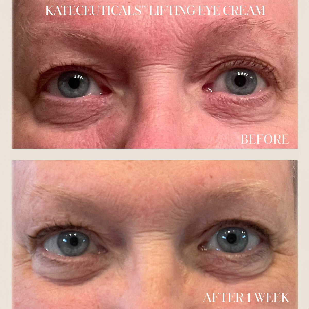 Kate Somerville KateCeuticals Lifting Eye Cream / 0.5OZ, image 28749755351190