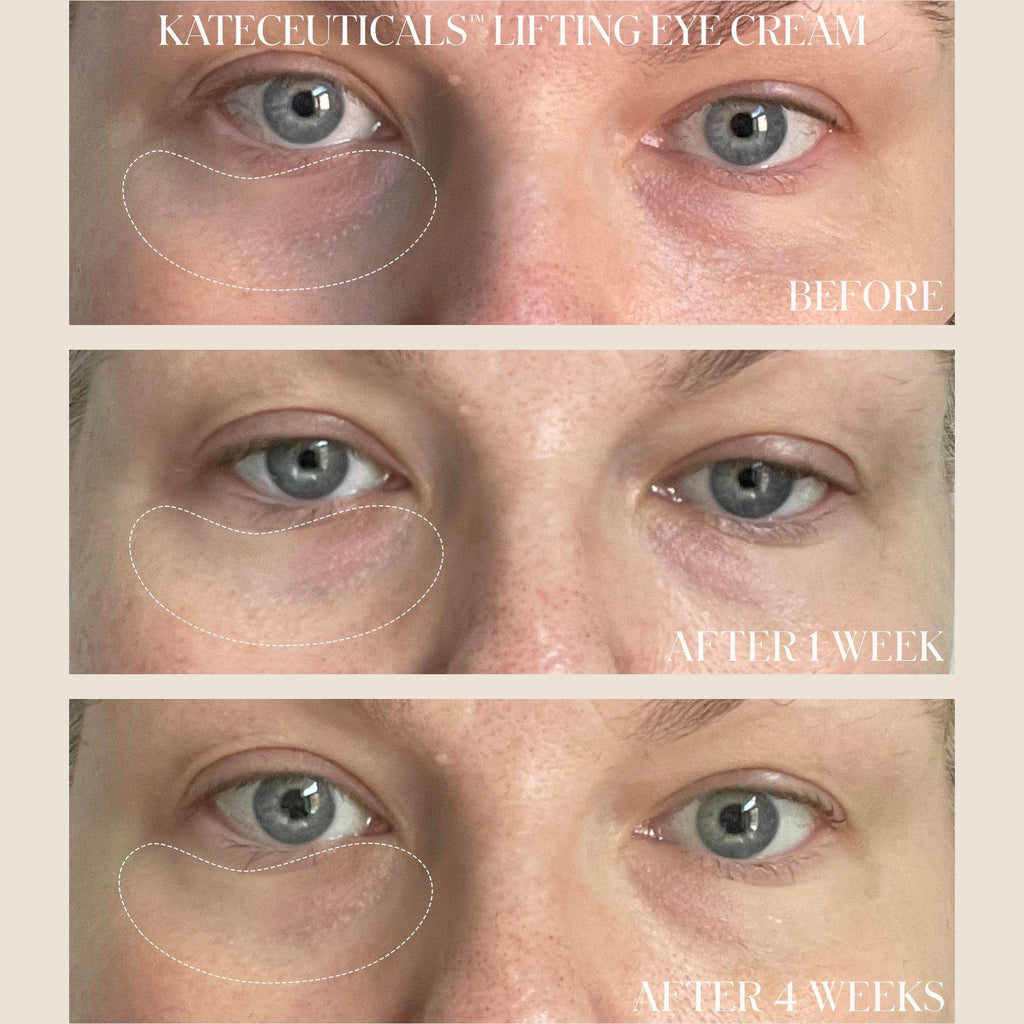 Kate Somerville KateCeuticals Lifting Eye Cream / 0.5OZ thumbnail 4