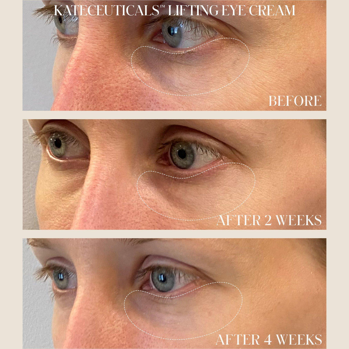 Kate Somerville KateCeuticals Lifting Eye Cream / 0.5OZ, image 28749755515030