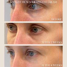 Kate Somerville KateCeuticals Lifting Eye Cream / 0.5OZ