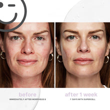 Kate Somerville KateCeuticals SuperCell Rejuvenation Serum / 1OZ