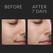 Kate Somerville Liquid ExfoliKate Triple Acid Resurfacing Treatment / 4OZ