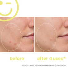 Kate Somerville Mega C 30% Vitamin C Brightening Facial / 2OZ