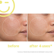 Kate Somerville Mega C 30% Vitamin C Brightening Facial / 2OZ