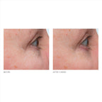 Kate Somerville + Retinol Firming Eye Cream / Default Title