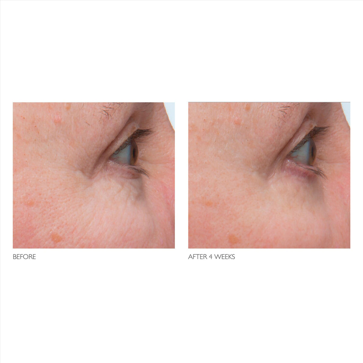 Kate Somerville + Retinol Firming Eye Cream / Default Title, image 28063746949270