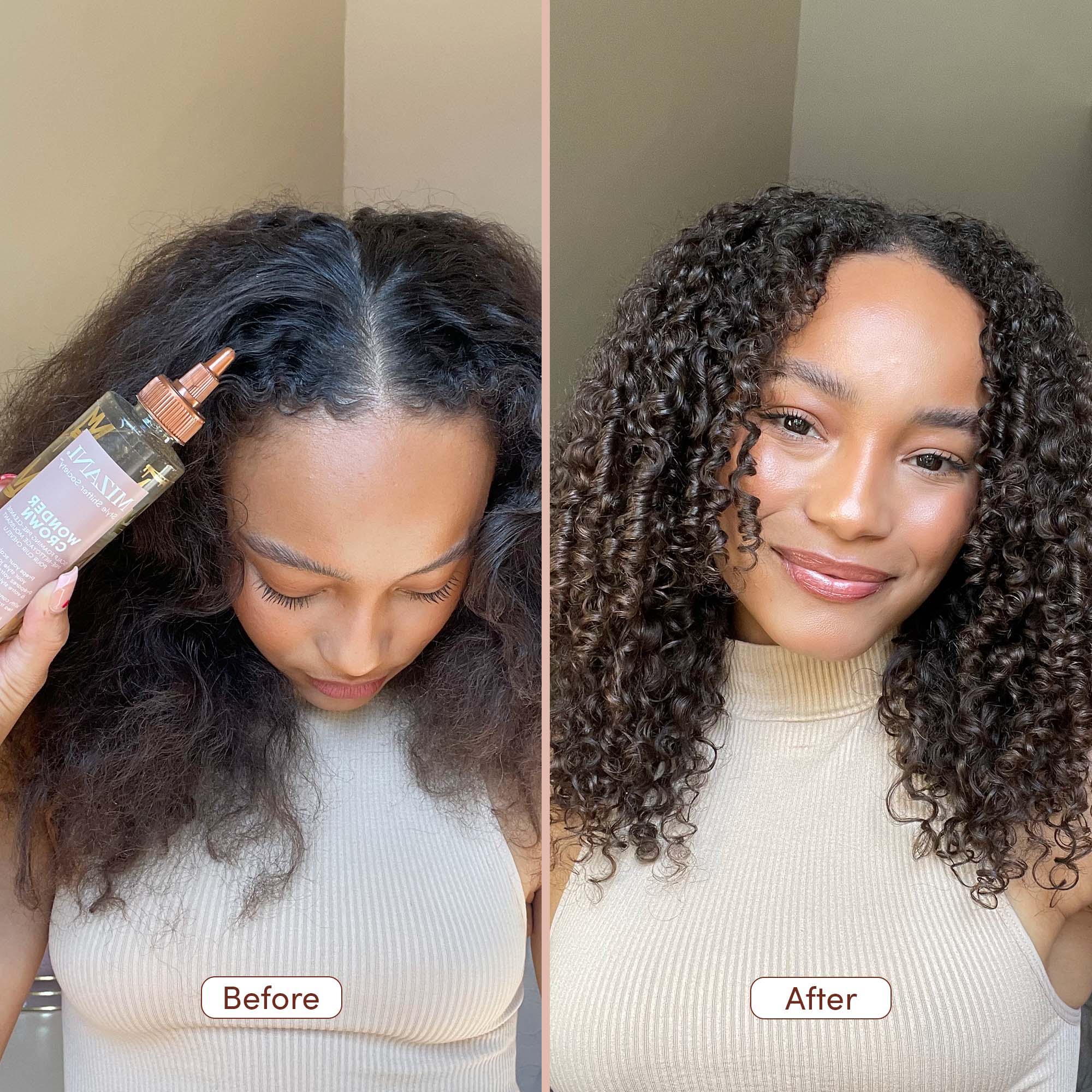 Mizani Wonder Crown - Haircare Essential – Planet Beauty