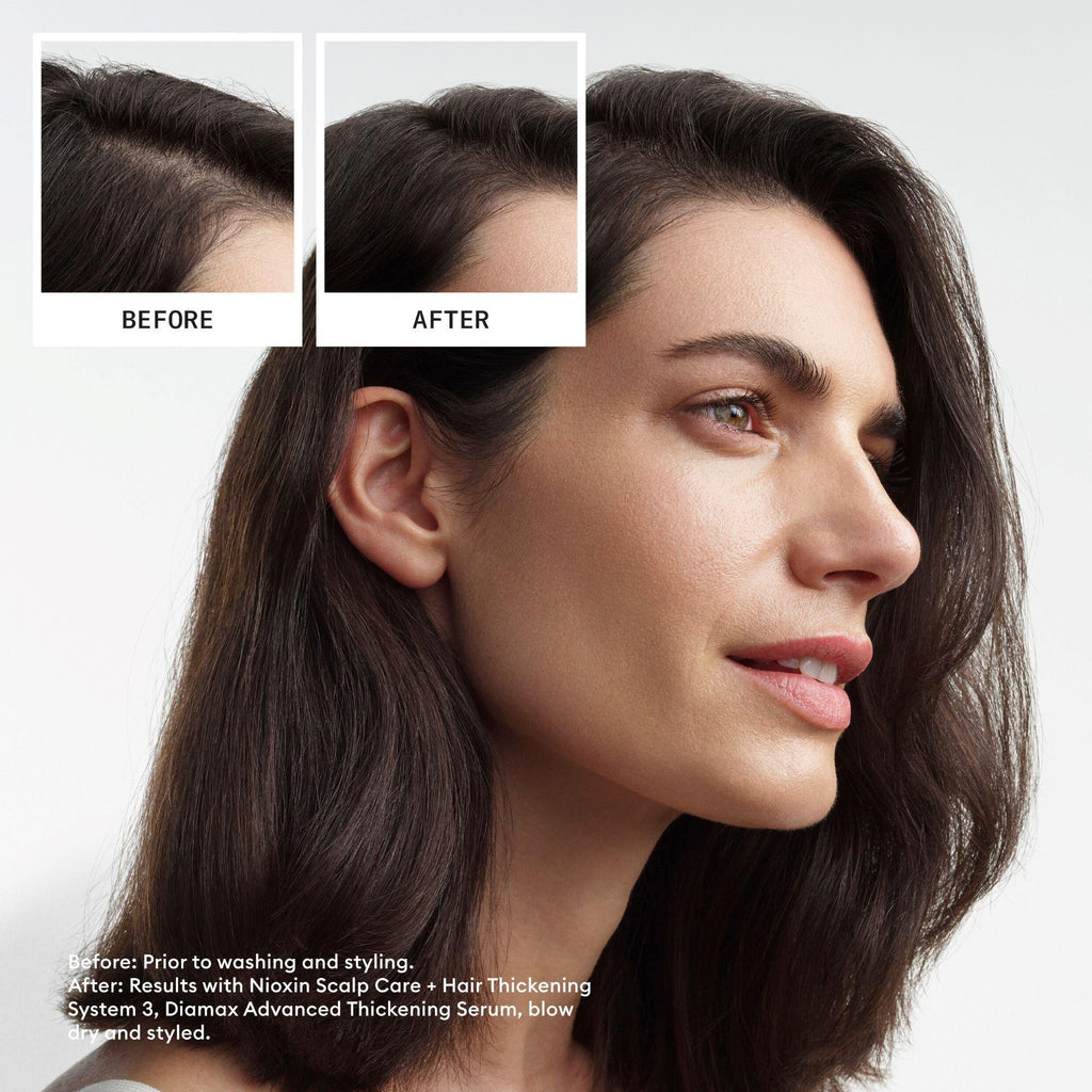 Nioxin System 3 Scalp Care + Hair Conditioner / 10.1OZ thumbnail 4