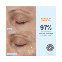 NuFace_Fix_Micro_Wand