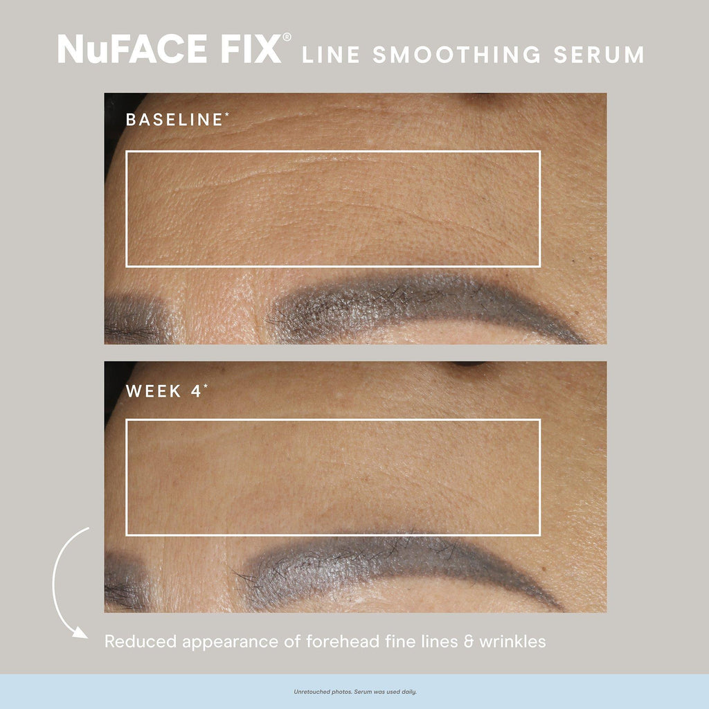 NuFace Fix Smoothing Serum / .5OZ thumbnail 8