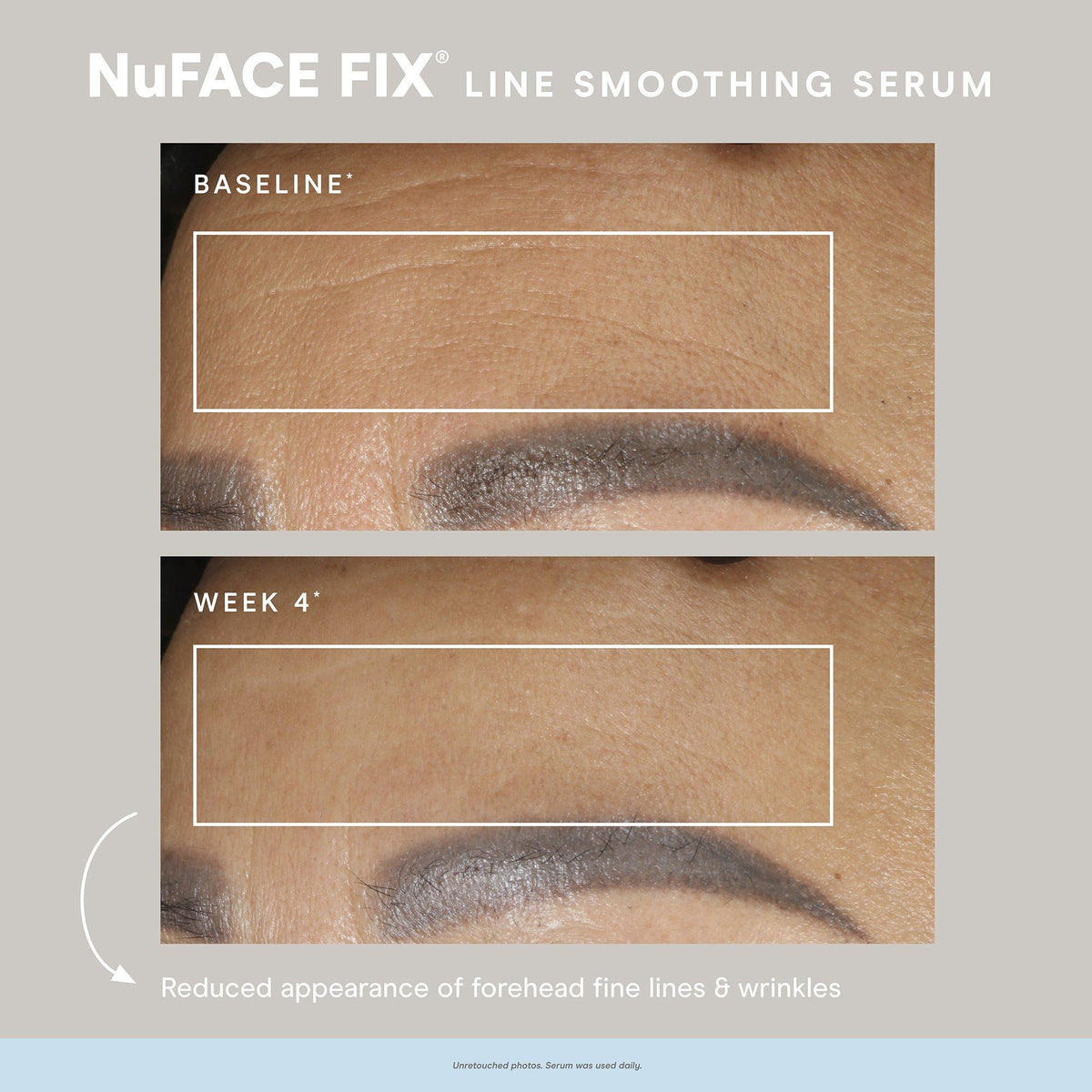 NuFace Fix Smoothing Serum / .5OZ, image 27784773959830