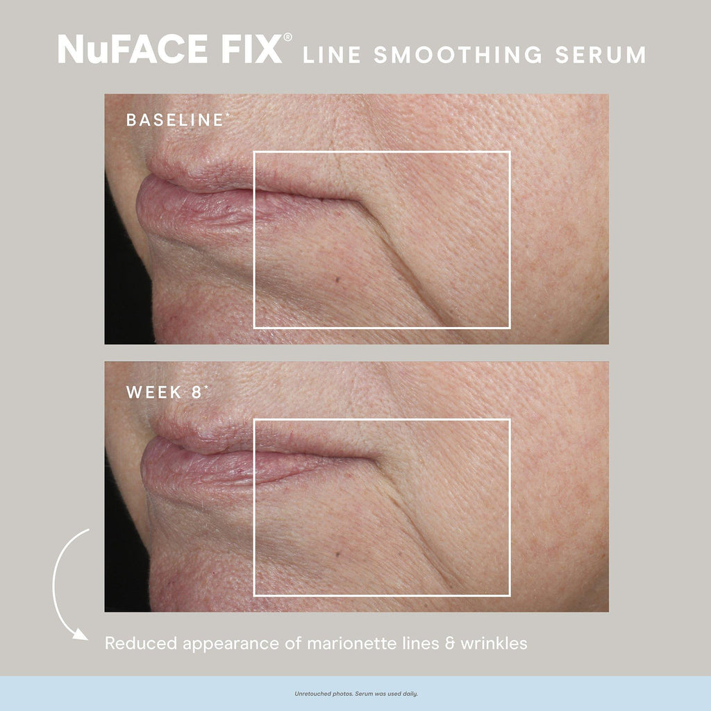 NuFace Fix Smoothing Serum / .5OZ thumbnail 7