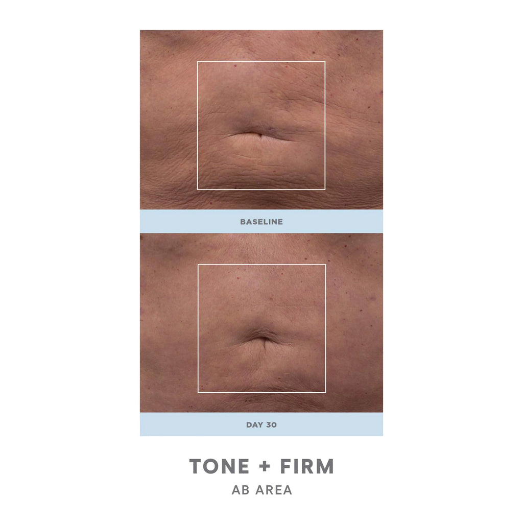 NuFace NuBody Skin Toning Device / KIT thumbnail 5