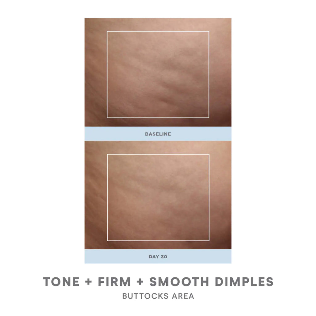 NuFace NuBody Skin Toning Device / KIT thumbnail 3