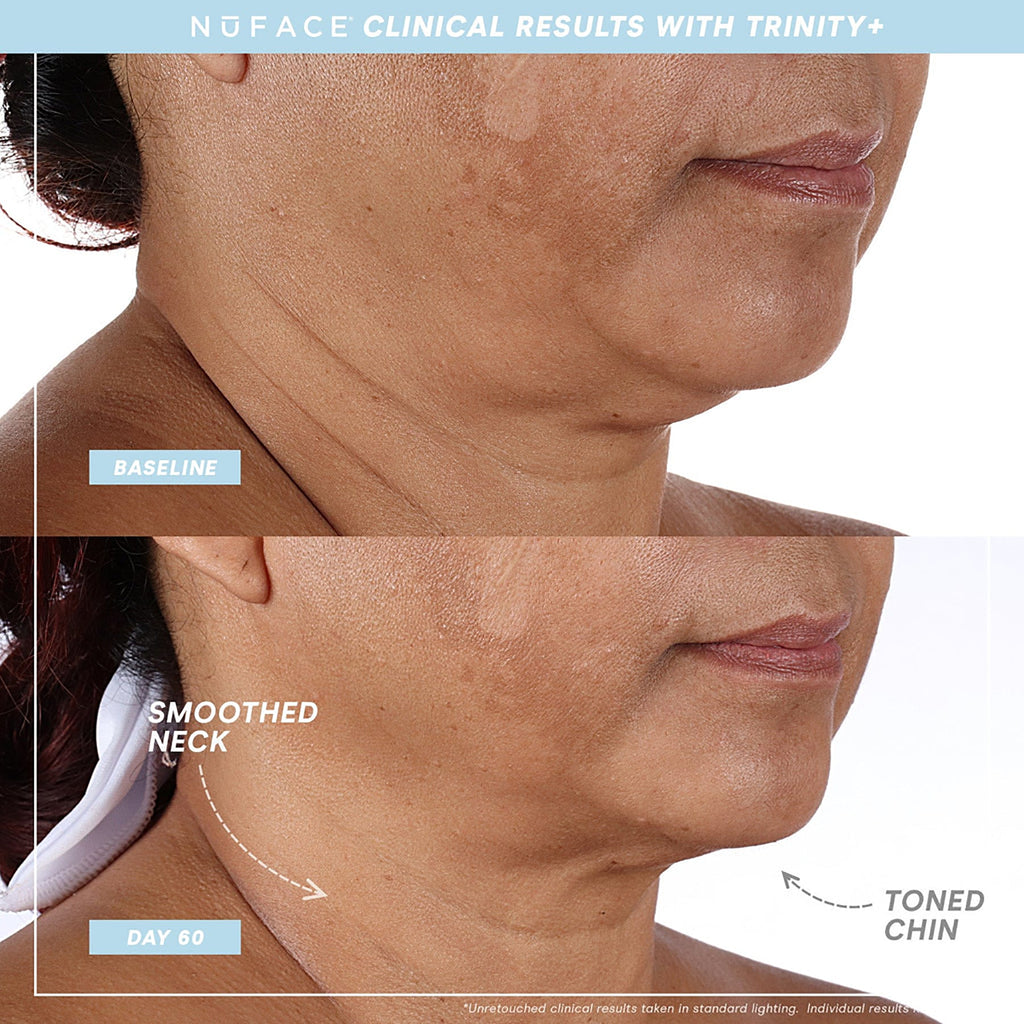 NuFace Trinity+ WITH Effective Lip & Eye Attachment Kit / KIT thumbnail 2