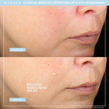 NuFace Trinity+ WITH Effective Lip & Eye Attachment Kit / KIT