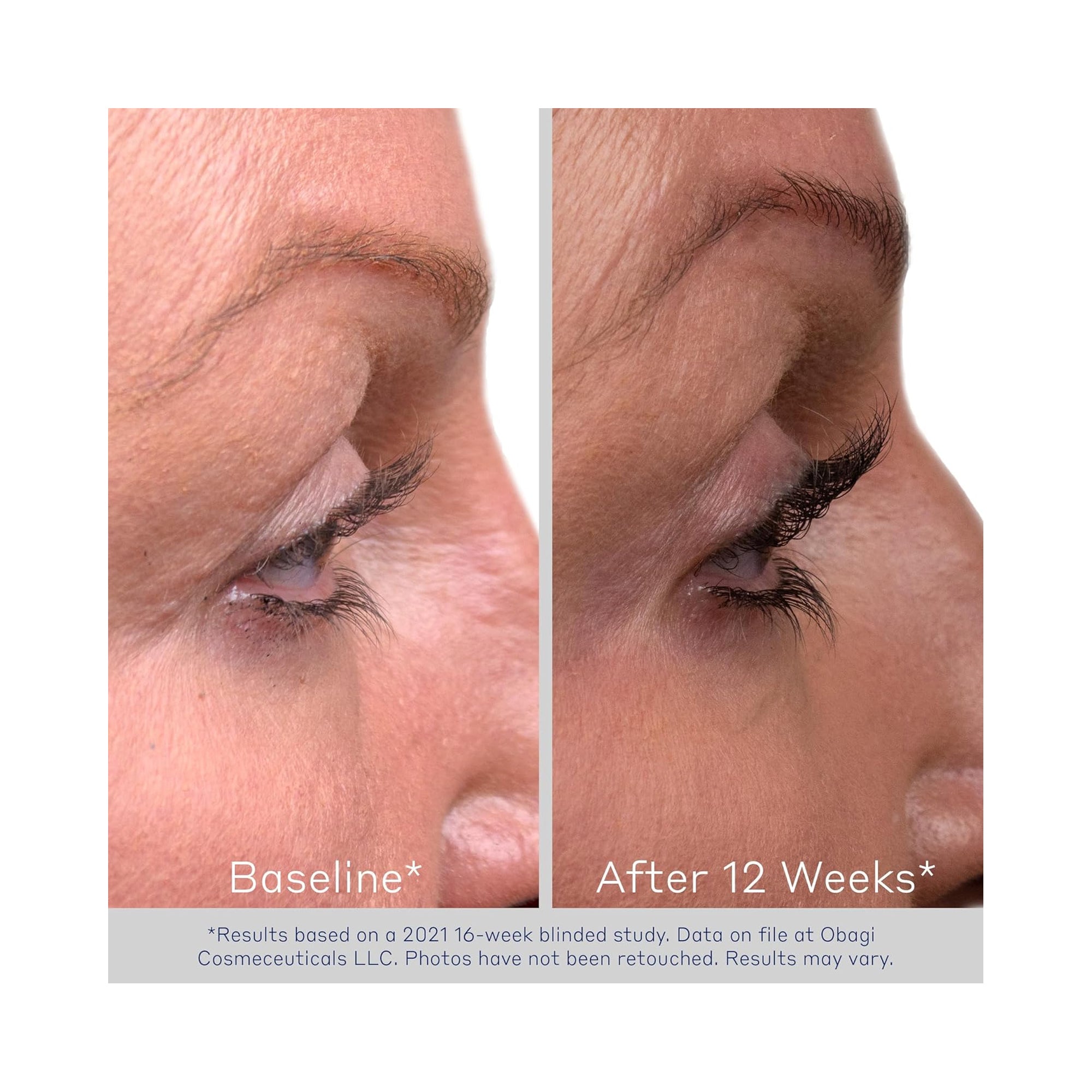 Obagi Nu-Cil Eyelash Enhancing Serum / 3ML