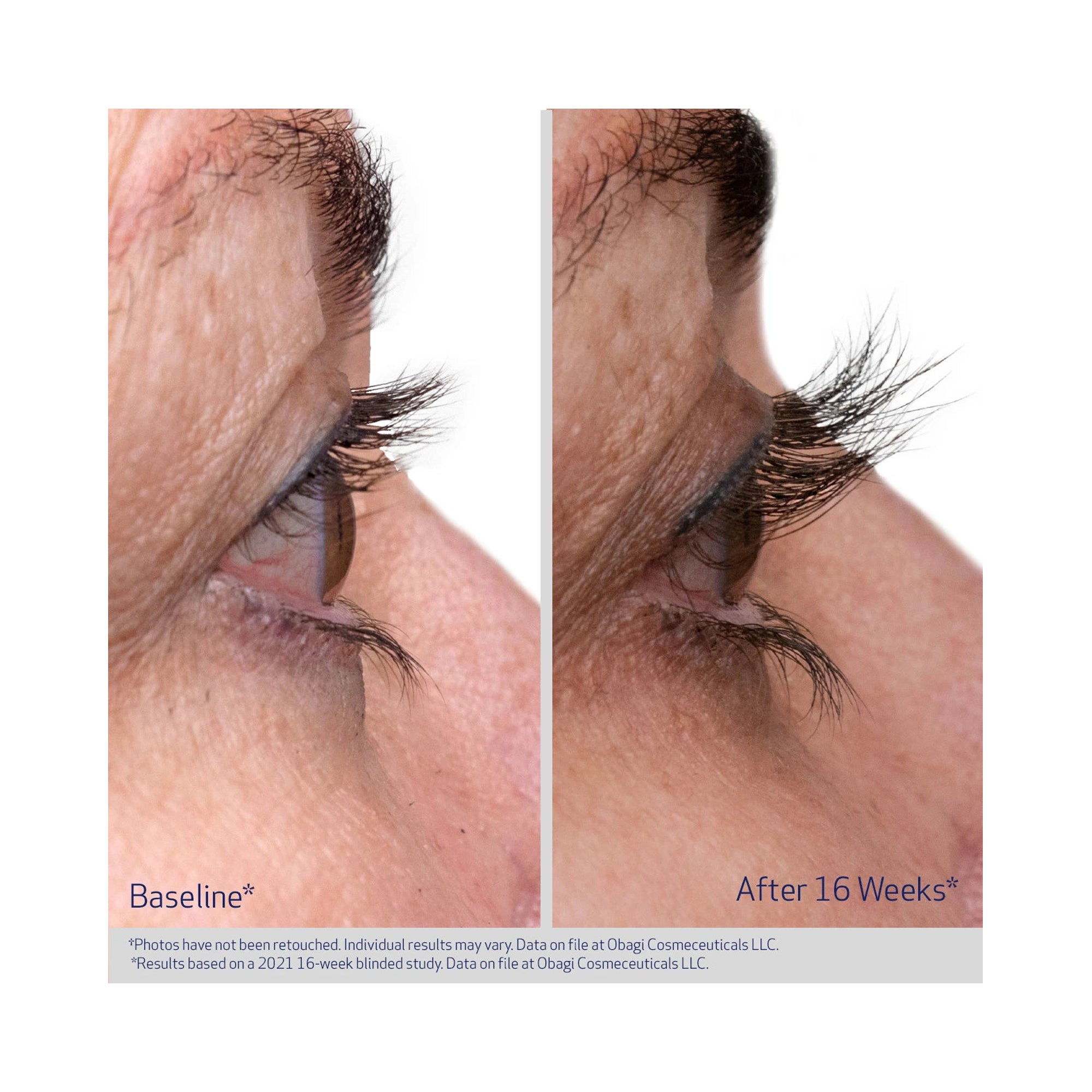 Obagi Nu-Cil Eyelash Enhancing Serum / 3ML