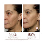 Nuface Mini+ Hydrate & Sculpt Kit ($289 Value)