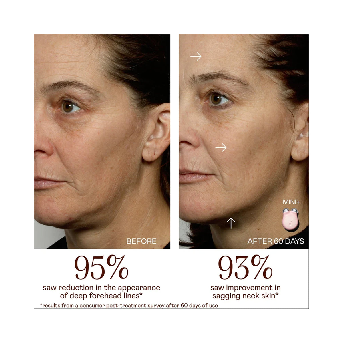 Nuface Mini+ Hydrate & Sculpt Kit ($289 Value), image 46249512894614