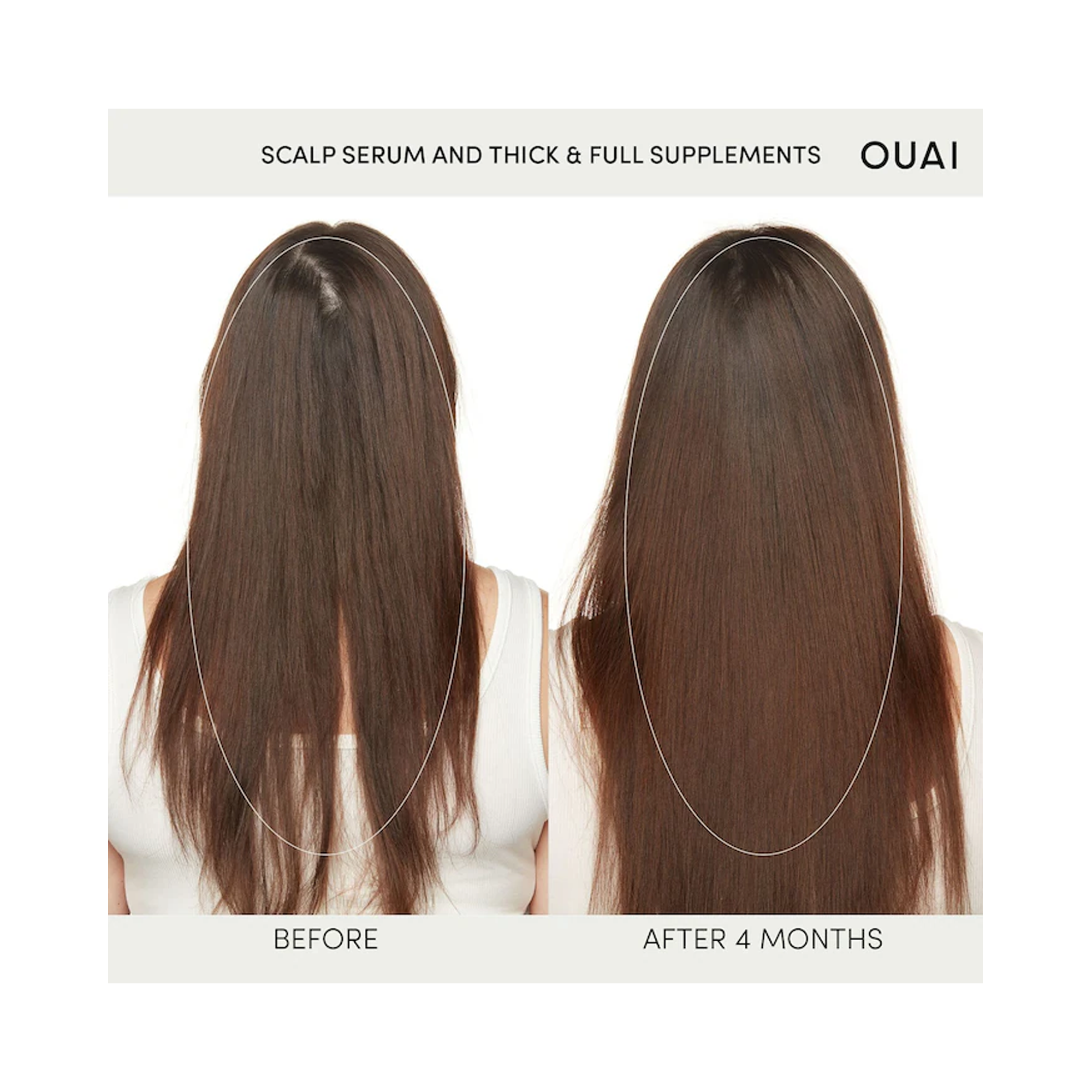 OUAI Scalp Serum / 2OZ