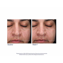 Obagi_Retinol_PHA_Refining_Night_Cream_1.7oz / 1.7OZ