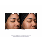 Obagi_Retinol_PHA_Refining_Night_Cream_1.7oz / 1.7OZ
