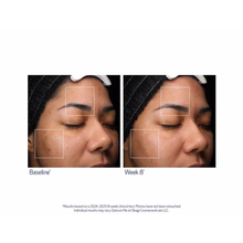 Obagi_Retinol_PHA_Refining_Night_Cream_1.7oz / 1.7OZ