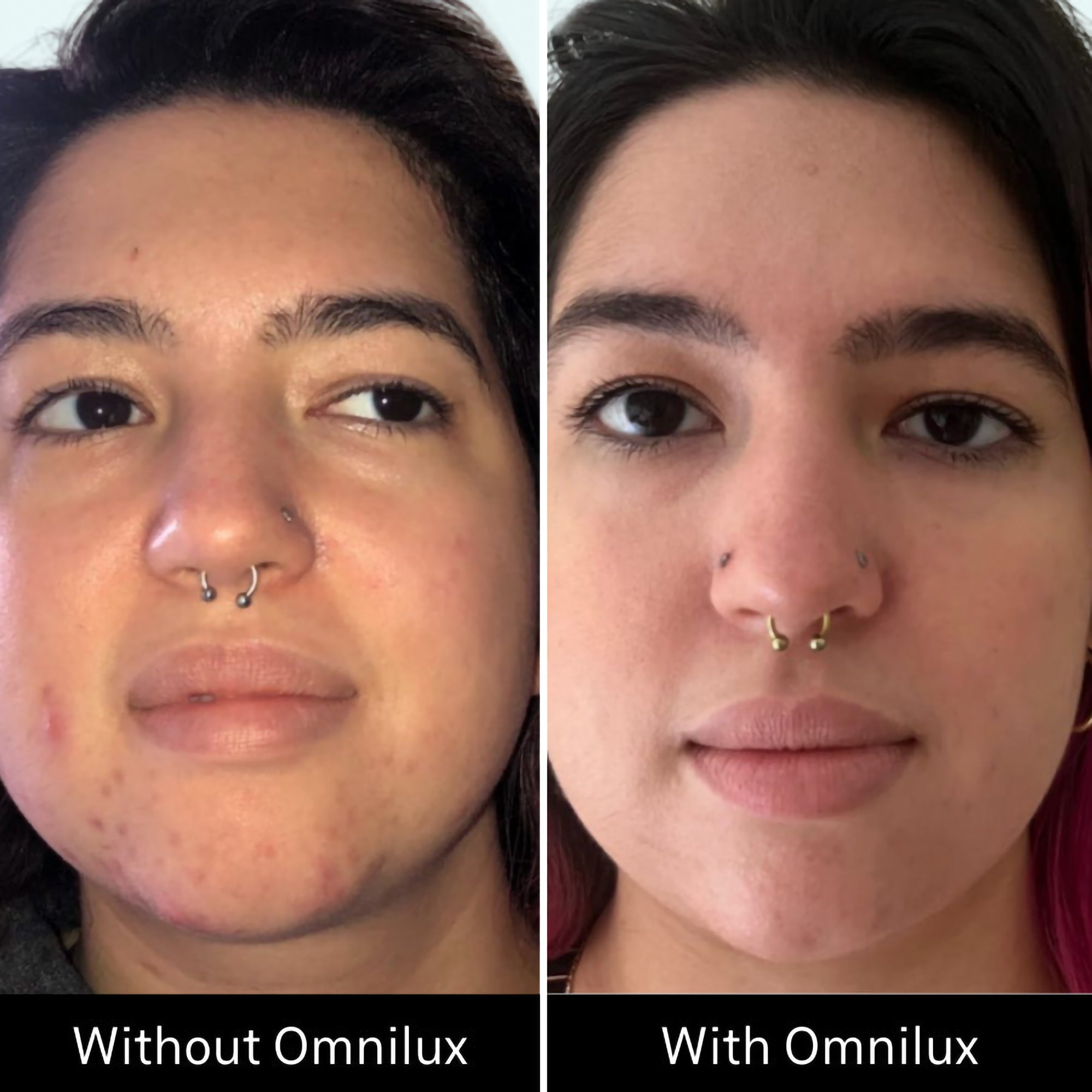 Omnilux Clear