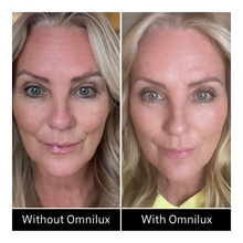 Omnilux Contour Face