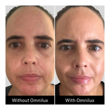 Omnilux Contour Face