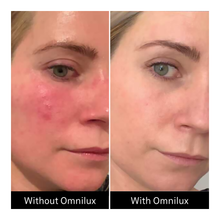 Omnilux Contour Face