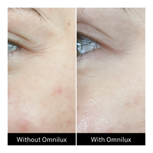 Omnilux Contour Face