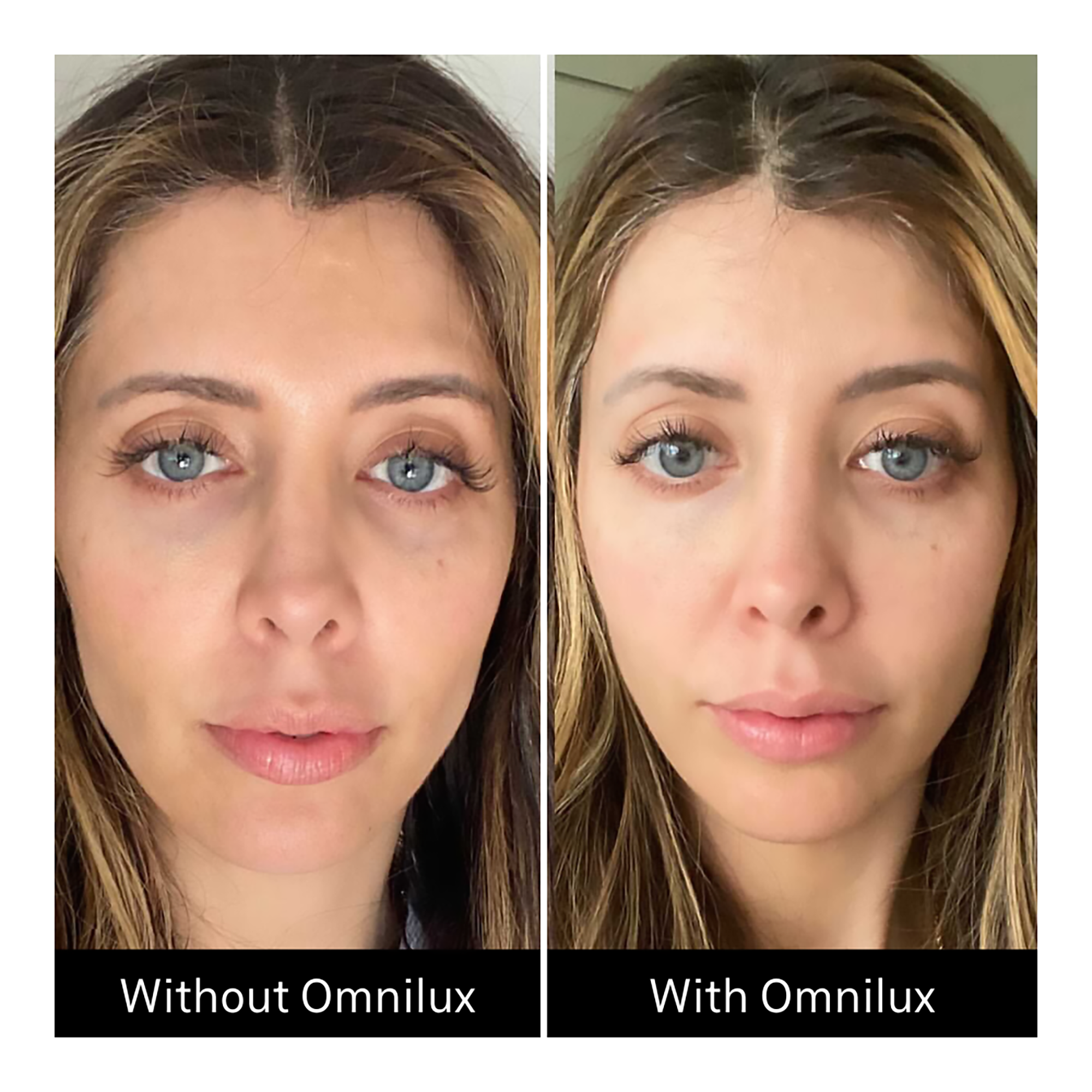 Omnilux Contour Face