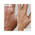 Omnilux Contour Glove
