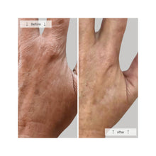 Omnilux Contour Glove