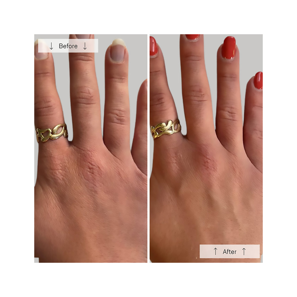 Omnilux Contour Glove, image 28945757995158