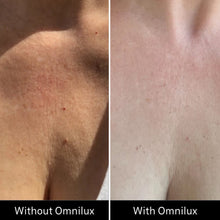 Omnilux Contour Neck & Decollete