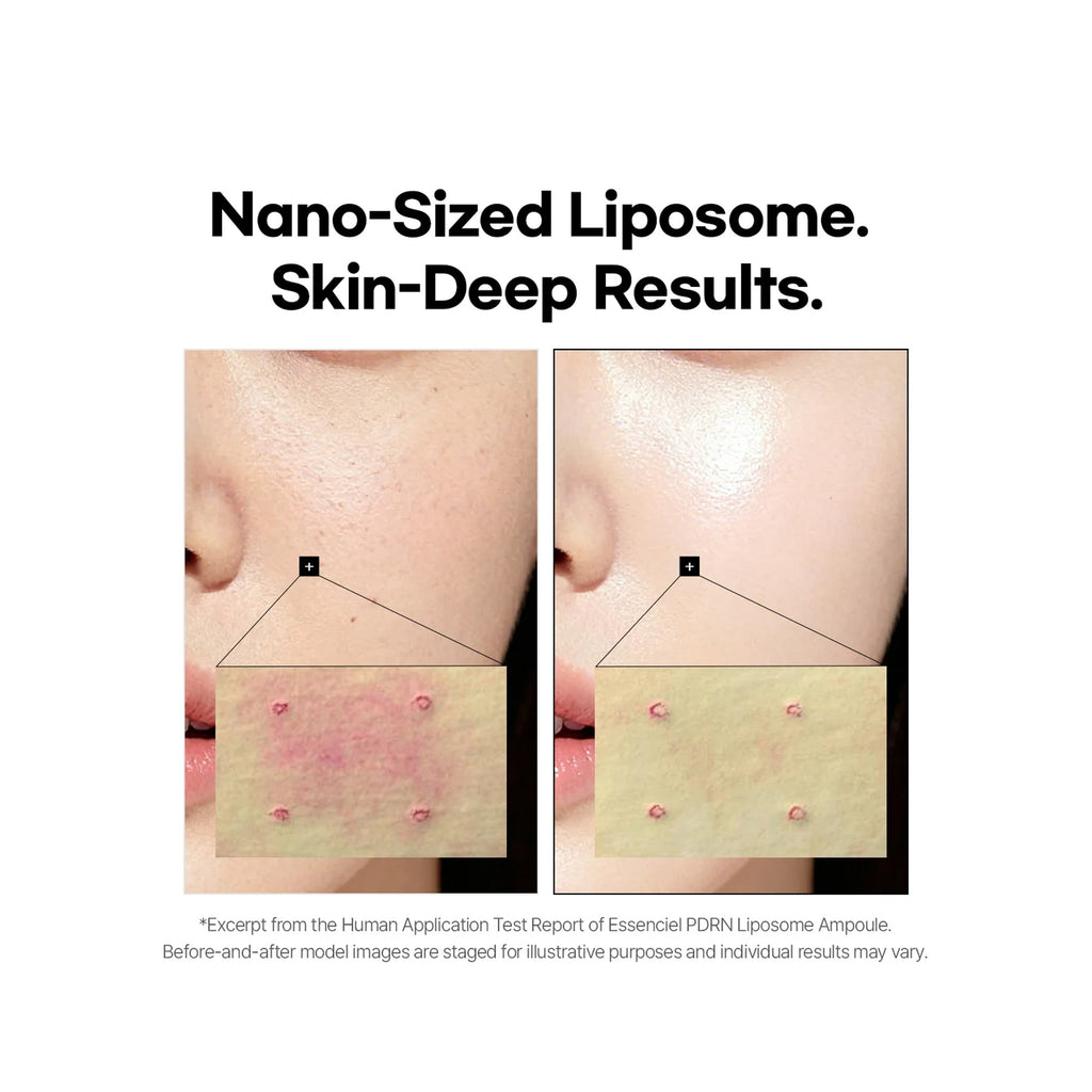 Before-and-after close-up of a person's cheek and mouth area showing skin texture and redness, with text reading 'Nano-Sized Liposome. Skin-Deep Results. thumbnail 4